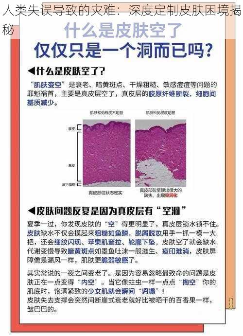 人类失误导致的灾难：深度定制皮肤困境揭秘